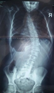 IMG_20150617_123153-2