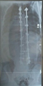 IMG_20150617_123235-2